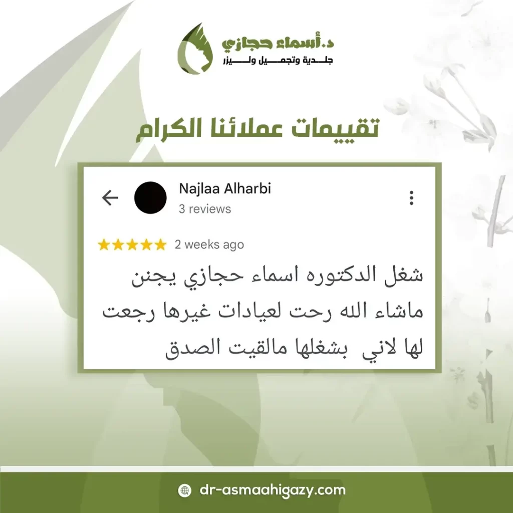 فيلر الانف